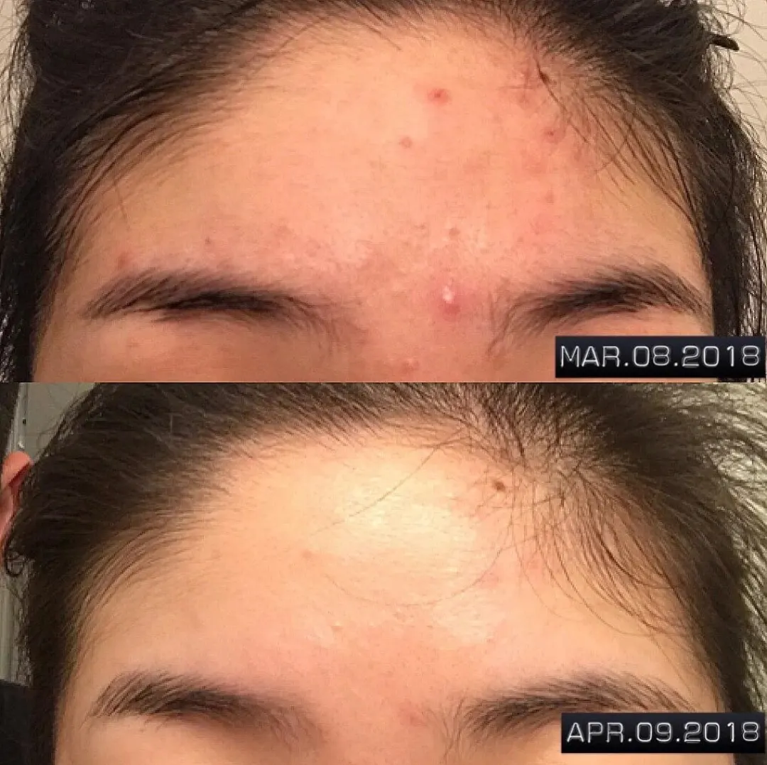 Ham UGC before/after